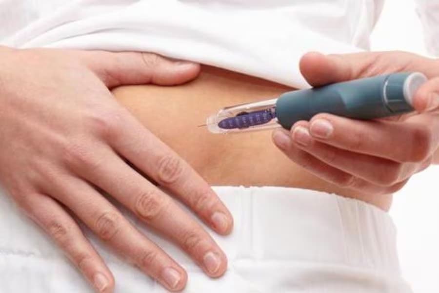 Tratamiento para el control de peso Modelo